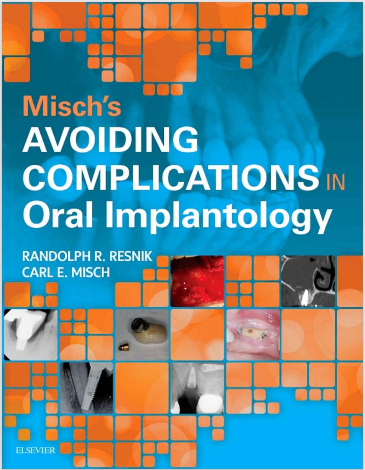 Cover of Misch's Avoiding Complications in Oral Implantology 1st Edition