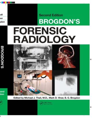 Brogdons Forensic Radiology, Second Edition by Michael J. Thali, Mark D. Viner, B.G. Brogdon
