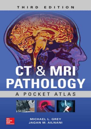 CT MRI Pathology A Pocket Atlas (Michael L Grey, Jagan Mohan Ailinani)