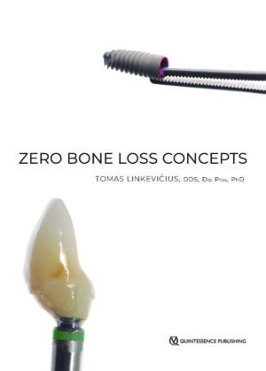 Zero Bone Loss Concepts 1st Edition by Tomas Linkevicius | 9780867157994